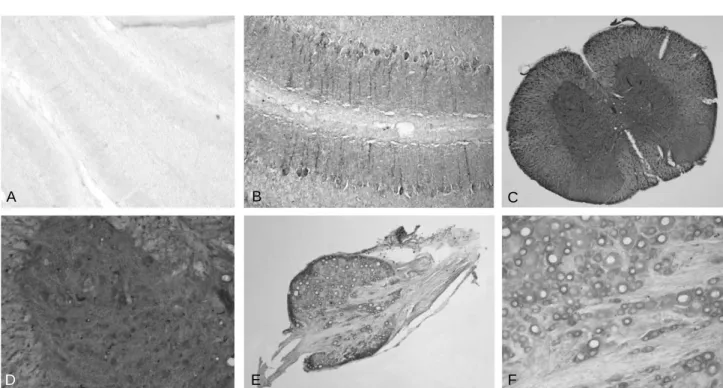 Fig. 4. Localization of a putaive ligand of TEM7 in the spinal cord and dorsal root ganglion
