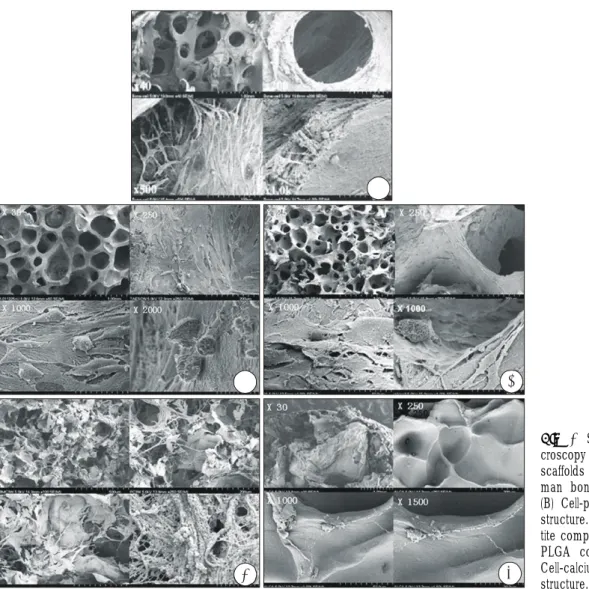 Fig. 2. Scanning electron mi- mi-croscopy image shows the  cell-scaffolds complex. (A) Cell-  hu-man bone complex structure