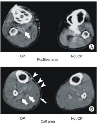 Table 2.  Diagnostic  result  of  USG  &amp;  MDCT  according  to  area  the  DVT  occurred