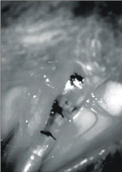 Fig. 1. Group 3 underwent the same procedure as Group 1, and the tendon was enveloped with a polylactic acid bioresorbable film.