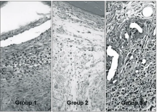 Fig. 4. There  were  many  a- a-cute  inflammatory  cells  1  week after surgery in group 1.
