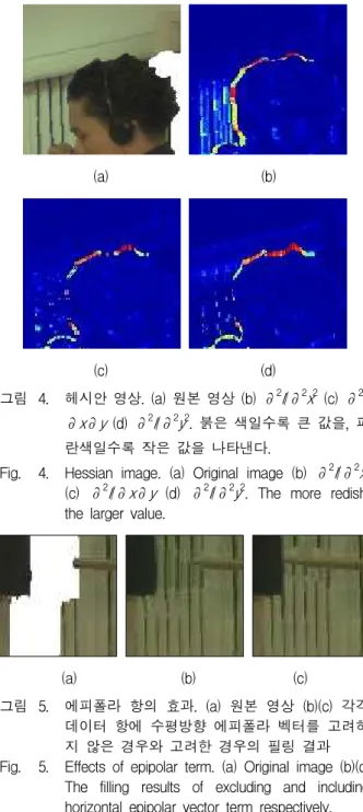 그림 4. 헤시안 영상. (a) 원본 영상 (b) ∂ 2 I/∂ 2 x 2 (c) ∂ 2 I/