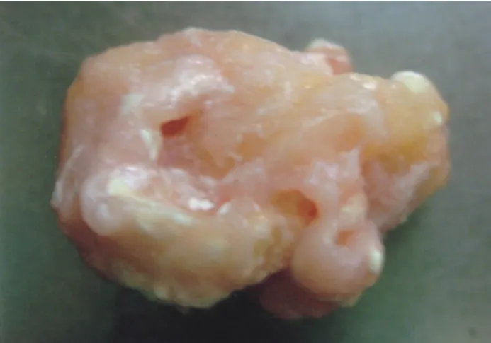 Fig. 3. The excised mass was whitish yellow colored with  multiloculated appearance.