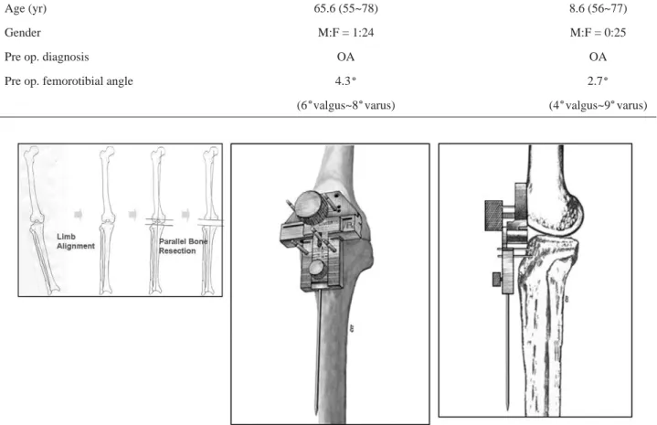Fig. 1. (A) In Linker technique, first step is soft tissue balancing and limb alignment correction, followed by parallel bone cutting for obtaining of rectengular space