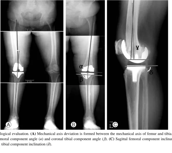 Fig. 2. Radiological evaluation. (A) Mechanical axis deviation is formed between the mechanical axis of femur and tibia