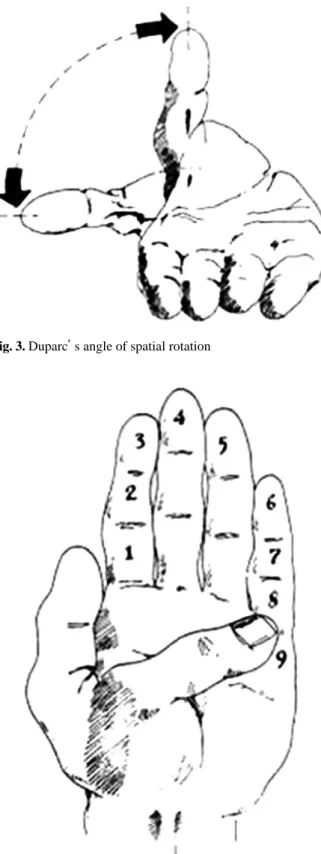 Fig. 3. Duparc’s angle of spatial rotation