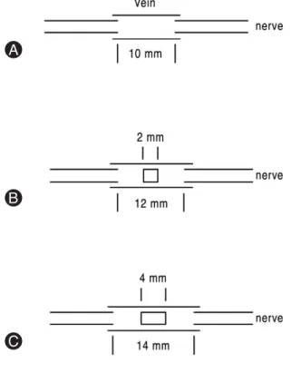 Fig. 1. Diagram of surgical intervention are shown in place.