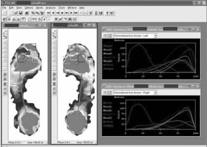 Figure  2.  Example  of  foot  scan  analysis  during  the  full  gait  cycle.