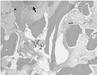 Figure  7.  Represntative  histopathologic  findings  of  osteochondral  lesion.  Bone  resorption  (black  arrow  head),  woven  bone  formation  (white  arrow  head),  fibrovascular  invasion  into  marrow  (asterisk),  and  enchondral  ossification  (ar