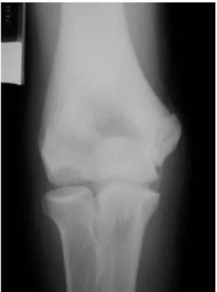 Fig. 2. MRI of the same lesion shown in figure 1.