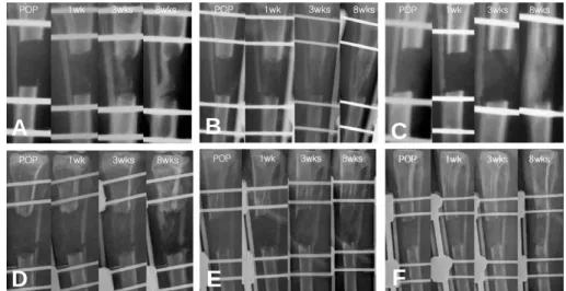 Fig. 2. Serial roentgenograms for groups 1 through 4: In group 1 (A), diffuse bone formation was seen at 3 weeks and consolidation was complete after 6 weeks, but only in the lateral portion of the defect
