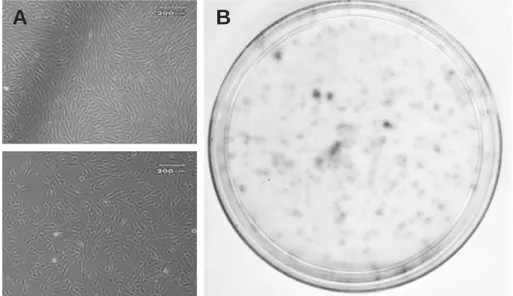 Fig. 1. Formation of colony of human bone marrow-derived stromal cells. Cultured human BMSCs are shown (A).