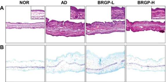 Fig. 8. Effect of BRGP on cutaneous cell infiltration and mast cell degranulation in TMA-induced AD mice