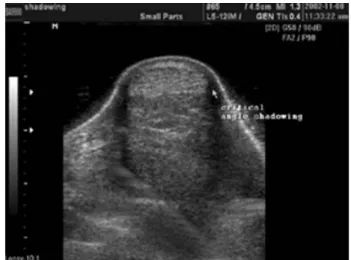 Fig. 9. Artificial image of the multiple bands by needle in the bursa 