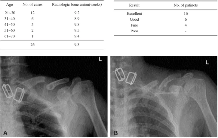 Table 1. Average bone union time after operation