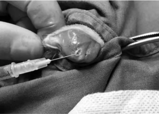 Fig. 1. Photograph of defect of the rotator cuff in a rat. Needle tip indicates the defect of the cuff.