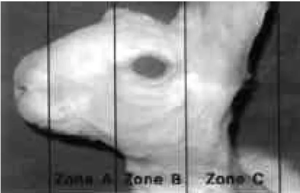 Table 2. Distribution of Area of Flap Necrosis in Individuals  with  Partial  Necrosis    in Experimental Group