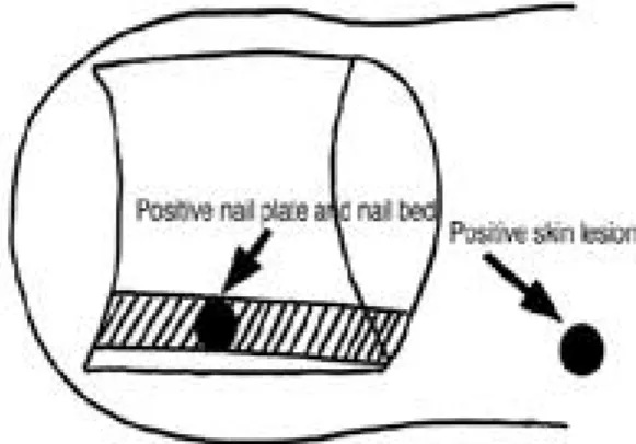Fig. 3. (A) The tumor cell nest is composed of some epithelioid and spindle-shaped tumor cells