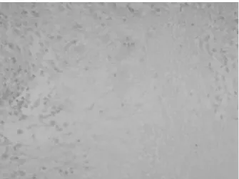Figure 4. AFB  stain  was  positive  finding  (H&amp;E  ×200).