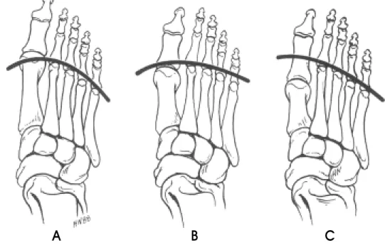 Figure 4. Digital  formula.  (A)  Egyptian  foot,  (B)  Greek  foot,  (C)  Squared  foot