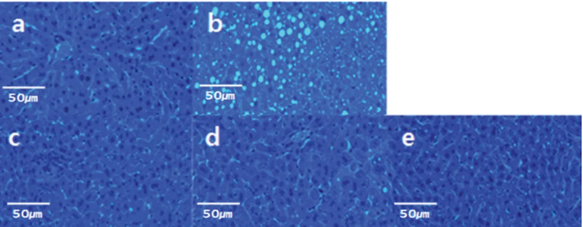 Fig. 1. Effect of cell-wall broken spores of Ganoderma lucidum on lipid accumulation in liver tissues of high-fat diet fed mice by histological assess (200×)