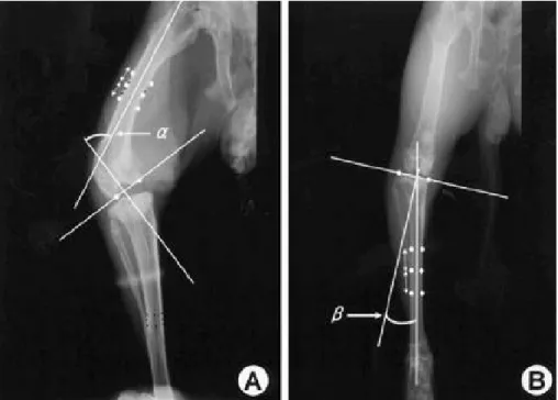 Fig. 1. Measurement of the varus angle (A) Distal femur; angle αis measured between the femoral axis line and a line orthogonal to one connecting the medial and lateral condyles