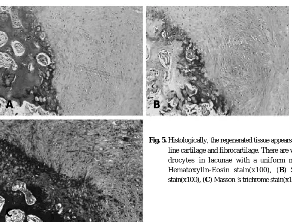 Table 1. Area covered with Regenerated Cartilage after Microfracture