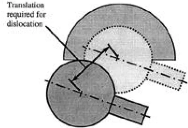 Fig. 1. Loops of nonabsorbable sutures in the capsule &amp;