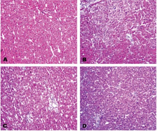Fig. 3. Histological sections on the effects of Korean white dandelion extract in the liver injury of rats induced by NDEA