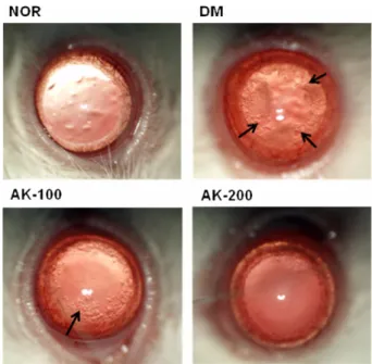 Fig. 1.  Slit-lamp microscopy. Representative image of lenses from normal control rat (Nor), streptozotocin induced diabetic rat (DM), DM rat treated with AK at concentration 100 mg/kg (AK-100) and DM rat treated with AK at concentration 200 mg/kg (AK-200)
