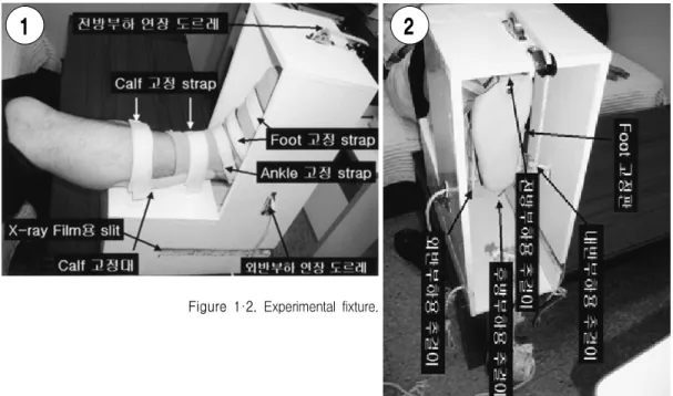 Figure 3. The  mesurement  of  fibular  length  and  mortise  angle.