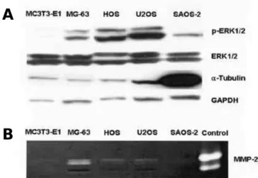 Fig. 1. ERK1/2 activation in osteosarcoma cell lines and zymography of osteosarcoma cell lines and osteoblast-like cell line