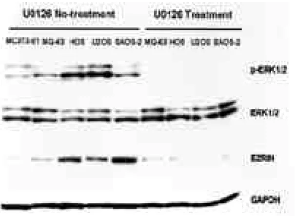 Fig. 2. The supression of ezrin expression was dependent on the ERK1/2 activation in osteosarcoma cell lines