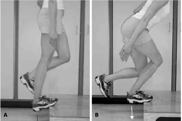Fig. 4. (A) straight - lef heel drop : eccentric strengthening of gastrocnemius (B) Bent - knee heel drop : eccentric strengthening of soleus.