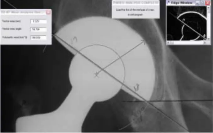 Fig. 1. Image displaying the wear analysis procedure, called the
