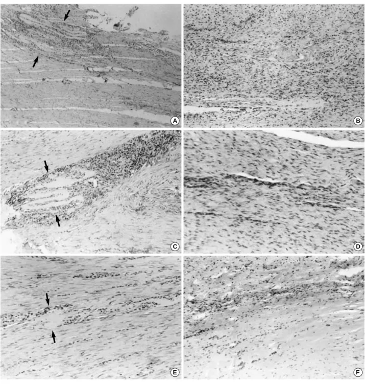 Fig. 2. Inflammatory cell infiltration in the two groups. Arrows represent the amniotic membrane