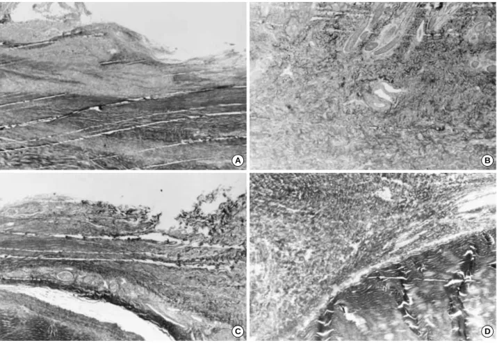 Fig. 3. Fibrosis in the two groups. After 1 week, the experimental group (A) showed some suppression of collagen fiber formation versus the control group (B)