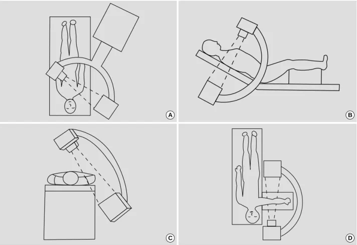 Fig. 1. (A) Tilt C-arm from operation table about 30 degrees. (B) Tilt C-arm from vertical line about 30 degrees