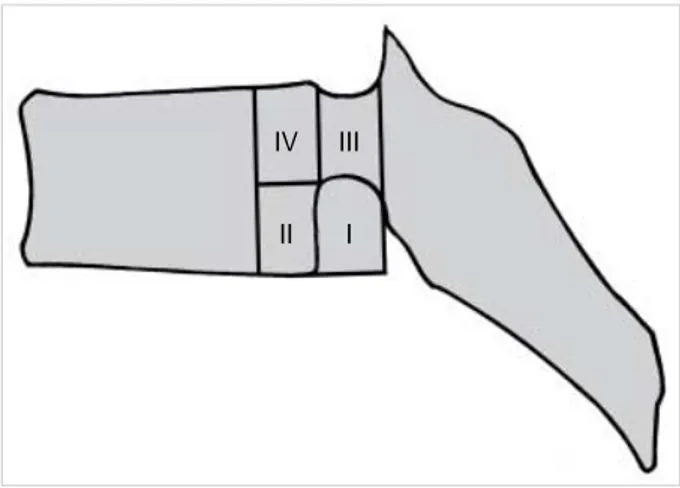 Fig. 1. Four dangerous zones on lateral radiographs are illustrated.