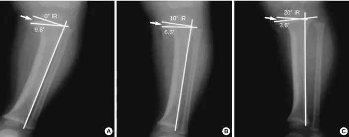 Table 1. Intra-observer measurement error (neutral limb rotation)