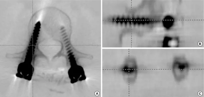 Fig. 3. Lines circumscribing the threaded portion of two screws are drawn with the central axes on inverted images