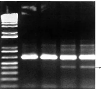 Fig. 5. Semi-quantitative RT-PCR  for MMP-2 expression. Thick bands indicate the internal control ( -actin)
