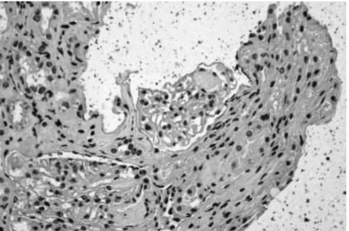 Fig. 3. A: Postoperative radiograph: After thorough curettage of the lesion, the defect was filled with allograft chip bones