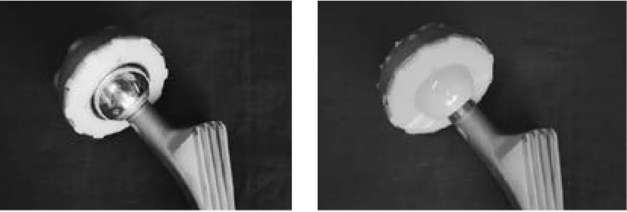 Fig. 2. In ceramic on polyethylene bearing associated with identical cup and stem, ceramic head  articu-lates with conventional polyethylene liner.
