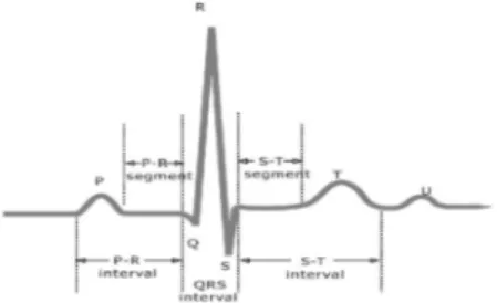 Fig. 1. P, Q, R, S and T wave in ECG signal