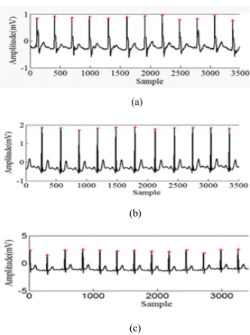 Fig. 8. R-Peak detection result using (a) 102, (b)          103and (c) 116 MIT/BIH arrhythmia data