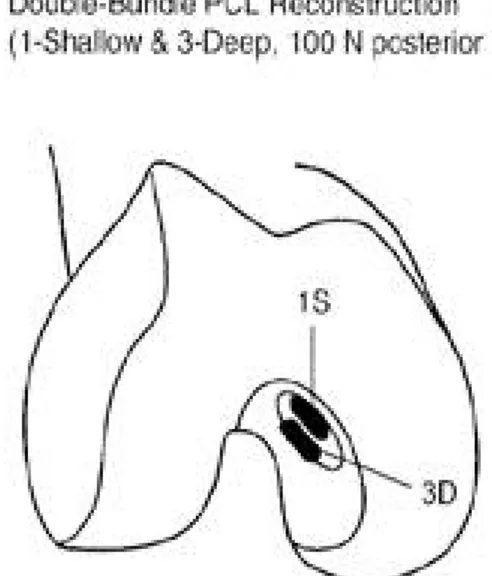 Fig. 2. Schematic drawing of ideal position in two bundle PCL reconstruction for reciprocal tension