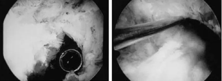 Fig. 4. The photography shows impingement test with rod. 