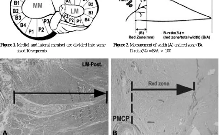 Figure 1. Medial and lateral menisci are divided into same sized 10 segments.