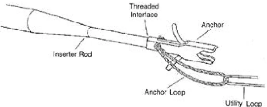Fig. 11. Knotless suture anchor design